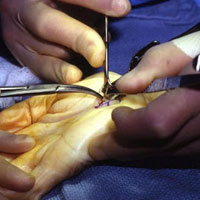 Centre For Hand Surgery