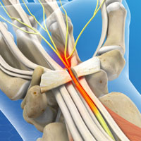 Centre for peripheral Nerve surgery